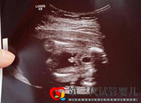 求锦鲤、望翻盘,想生男孩的她们有多努力?(图1) 求锦鲤、望翻盘,想生男孩的她们有多努力?(图1)