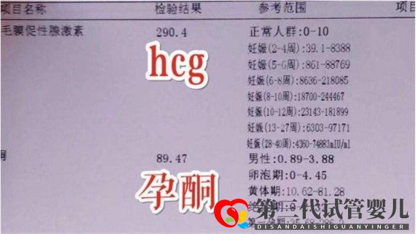 通过试管婴儿移植后多久可以验孕验孕成功后多久可以测胎心(图1) 通过试管婴儿移植后多久可以验孕验孕成功后多久可以测胎心(图1)