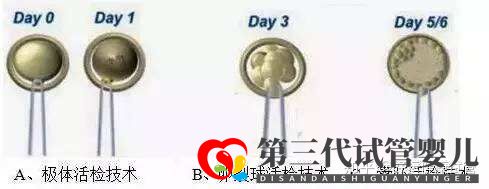 三代试管知男女的必经之路—胚胎活检术(图1) 三代试管知男女的必经之路—胚胎活检术(图1)
