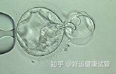 三代试管知男女的必经之路—胚胎活检术(图4) 三代试管知男女的必经之路—胚胎活检术(图4)