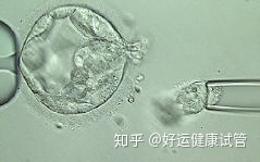 三代试管知男女的必经之路—胚胎活检术(图6) 三代试管知男女的必经之路—胚胎活检术(图6)