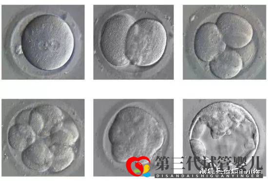 试管婴儿移植后多久算成功(图1) 试管婴儿移植后多久算成功(图1)