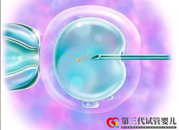 通俗易懂的一、二、三代试管婴儿解说(图2) 通俗易懂的一、二、三代试管婴儿解说(图2)