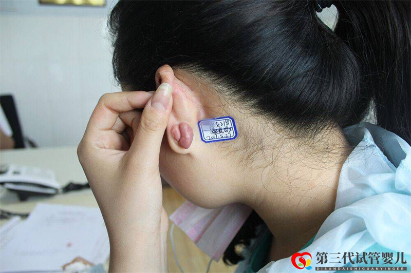 郑州去疤痕的医院哪家好(图1)