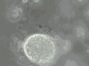 精子碎片率高可以做三代试管婴儿吗?(图1) 精子碎片率高可以做三代试管婴儿吗?(图1)