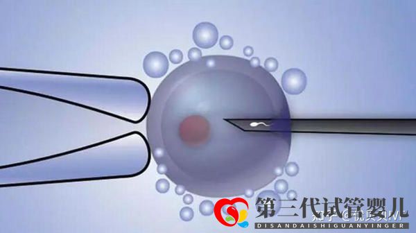 国内排名靠前的三代试管医院都有哪些第一梯队了解下(图3) 国内排名靠前的三代试管医院都有哪些第一梯队了解下(图3)