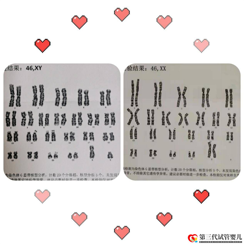 为什么父母染色体正常,胚胎染色体却有问题?(图1) 为什么父母染色体正常,胚胎染色体却有问题?(图1)