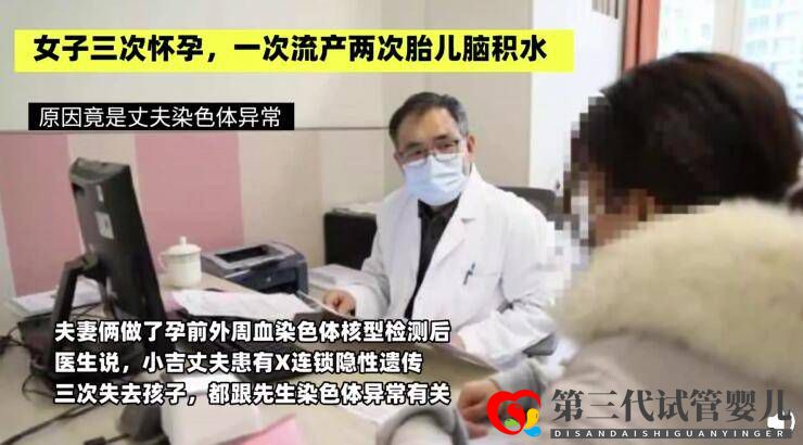 女子三次怀孕一次流产两次胎儿脑积水原因竟是丈夫染色体异常(图2) 女子三次怀孕一次流产两次胎儿脑积水原因竟是丈夫染色体异常(图2)