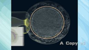 第三代试管婴儿真的最好最先进吗国内哪里可以做(图2) 第三代试管婴儿真的最好最先进吗国内哪里可以做(图2)