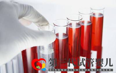 肝功检查可以筛查肝癌吗(图1) 肝功检查可以筛查肝癌吗(图1)