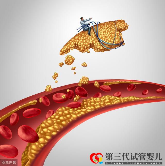 颈动脉斑块筛查,能降低心脑血管事件发生吗?(图2) 颈动脉斑块筛查,能降低心脑血管事件发生吗?(图2)