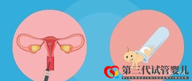 国内第三代试管婴儿可以选择性别吗心悦告诉你(图2) 国内第三代试管婴儿可以选择性别吗心悦告诉你(图2)