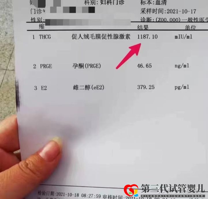 试管婴儿第三代技术包成功“生男孩”真的可以生儿子(图2) 试管婴儿第三代技术包成功“生男孩”真的可以生儿子(图2)