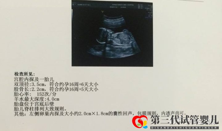 女人做了试管人就废了其中的辛酸苦不堪言,但我不(图2) 女人做了试管人就废了其中的辛酸苦不堪言,但我不(图2)