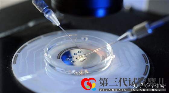 高龄做试管怎样才能提高成功率(图4) 高龄做试管怎样才能提高成功率(图4)