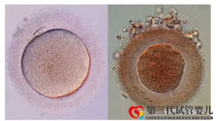高龄女性试管多次失败,应该何去何从(图1) 高龄女性试管多次失败,应该何去何从(图1)