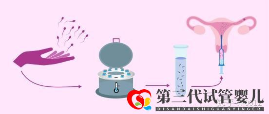 人授还是试管应该怎么选(图1) 人授还是试管应该怎么选(图1)