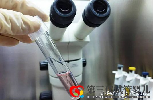 人工授精跟试管婴儿的区别(图9) 人工授精跟试管婴儿的区别(图9)