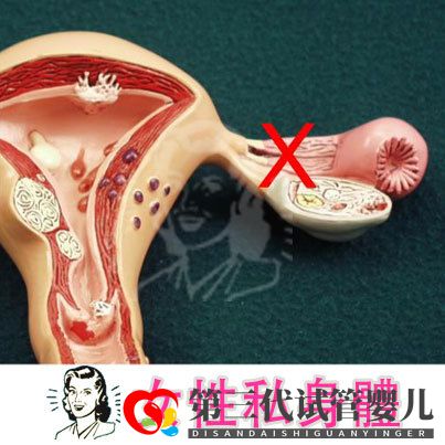 输卵管堵塞,怀孕到底有多难(图1) 输卵管堵塞,怀孕到底有多难(图1)