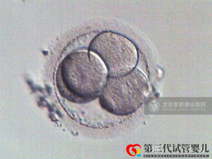 输卵管堵塞是先疏通还是直接试管(图4) 输卵管堵塞是先疏通还是直接试管(图4)