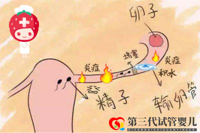 报喜万家!输卵管积水的她放弃做试管,却凭一剂中药喜获“好孕”(图1) 报喜万家!输卵管积水的她放弃做试管,却凭一剂中药喜获“好孕”(图1)