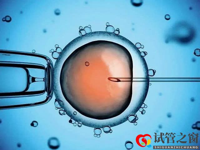 关于试管婴儿促排卵,您想知道的都在这里!(图1) 关于试管婴儿促排卵,您想知道的都在这里!(图1)