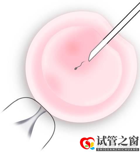 关于试管婴儿,你想知道的都在这里,不懂就得多看看(图1) 关于试管婴儿,你想知道的都在这里,不懂就得多看看(图1)