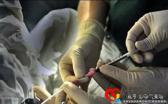 直击试管婴儿的过程(图2) 直击试管婴儿的过程(图2)