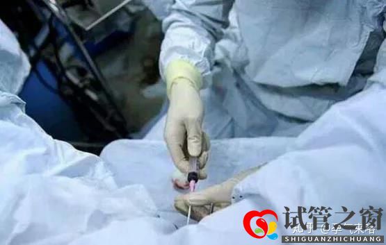 直击试管婴儿的过程(图6) 直击试管婴儿的过程(图6)