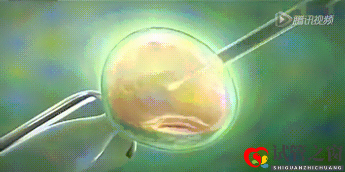 哪些人群需要做供卵试管婴儿?(图2) 哪些人群需要做供卵试管婴儿?(图2)