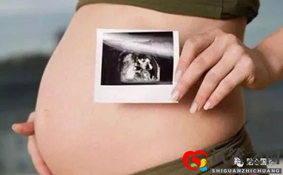 高龄选择做第三代试管婴儿注意事项有哪些?(图1) 高龄选择做第三代试管婴儿注意事项有哪些?(图1)