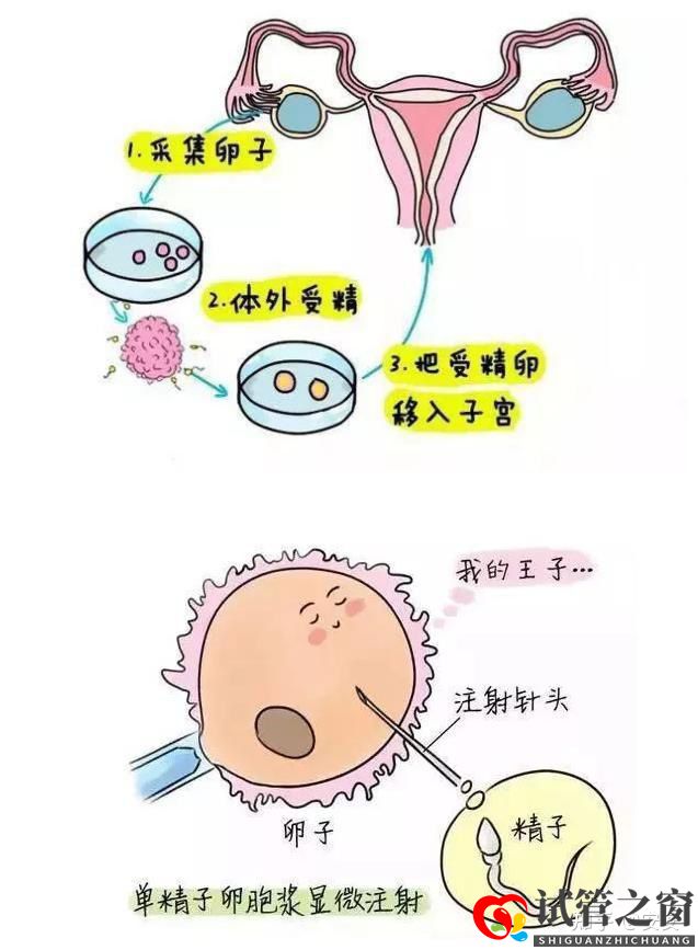 “试管婴儿又不是亲生的,多丢人”(图1) “试管婴儿又不是亲生的,多丢人”(图1)
