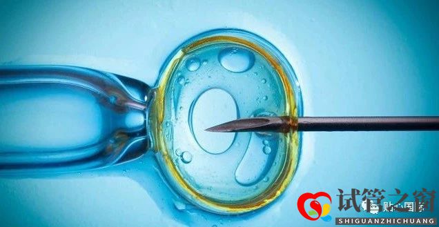试管婴儿4大流程,让你了解它究竟是什么(图1) 试管婴儿4大流程,让你了解它究竟是什么(图1)