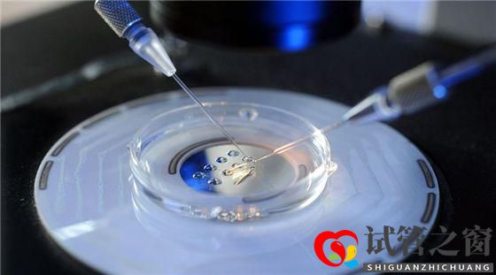 多囊卵巢综合症能做试管婴儿吗(图1) 多囊卵巢综合症能做试管婴儿吗(图1)