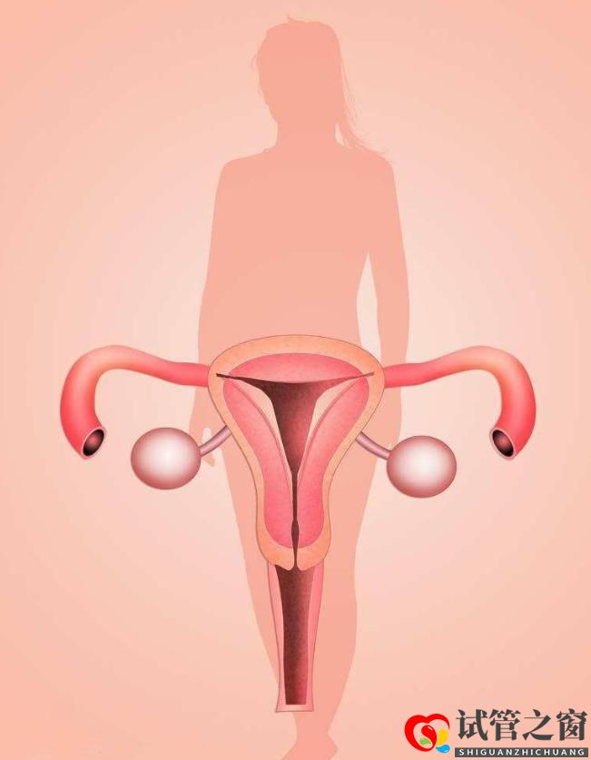 输卵管通而不畅一定要做试管吗?(图1) 输卵管通而不畅一定要做试管吗?(图1)