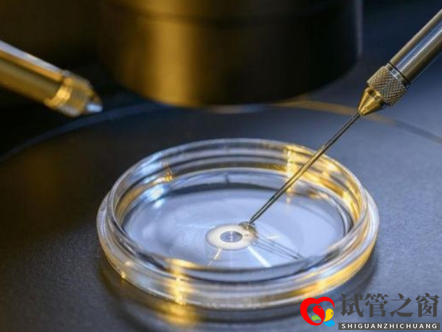 无精症做二代试管成功案例分享,从“一无所有”到“无中生有“(图3) 无精症做试管成功率在30%左右