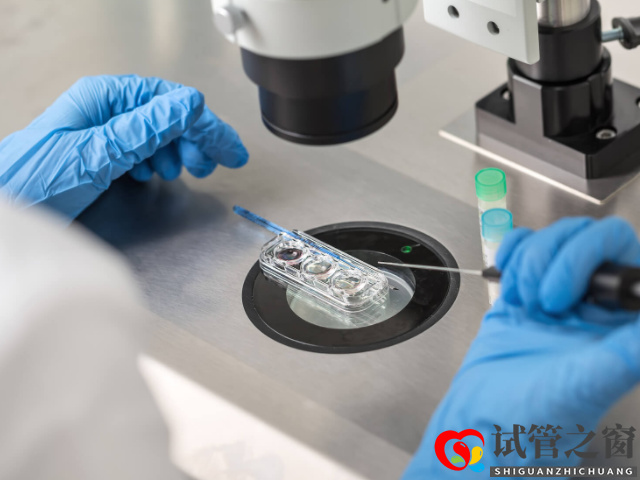 无精和死精区别盘点,揭露两者不同情况的严重程度(图2) 无精和死精的诊断标准不一样