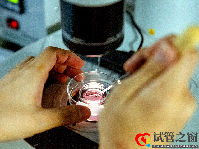 无精和死精区别盘点,揭露两者不同情况的严重程度(图4) 无精症比死精症严重