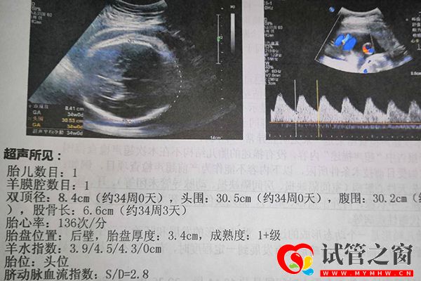 解读试管移植一、二、三超检查,按时过了二超也并非安全(图2) 试管婴儿一超确定胎儿是否宫内妊娠