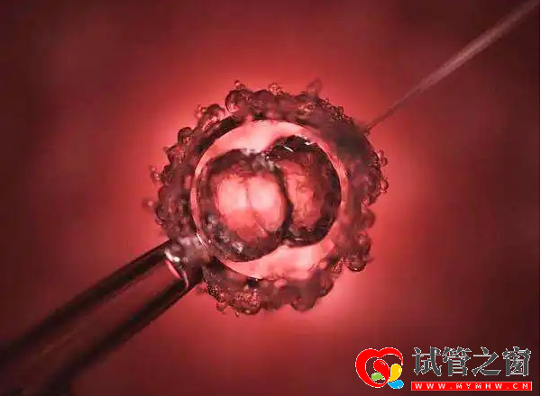 正常卵泡发育对照图表,5分钟了解卵泡生长的全过程(图1) 卵泡发育至成熟就会排出