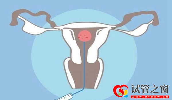 进行三代试管婴儿会有什么风险吗(图3) 进行三代试管婴儿会有什么风险吗(图3)