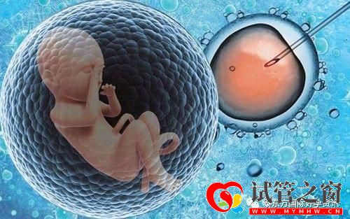 去美国做试管婴儿要多久最短3天即可(图1) 去美国做试管婴儿要多久最短3天即可(图1)