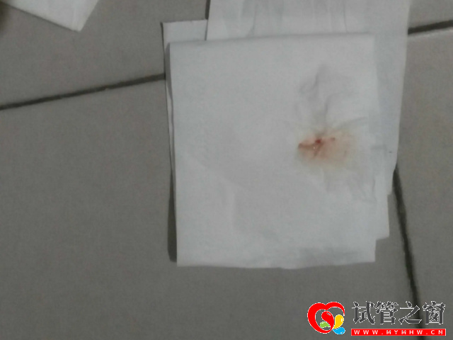 典型受精卵成功着床褐色分泌物图片,别与月经混为一谈(图1) 受精卵成功会少量出血