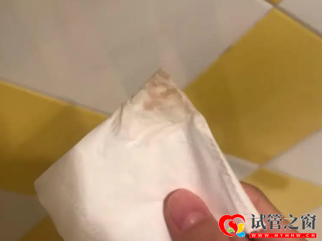 典型受精卵成功着床褐色分泌物图片,别与月经混为一谈(图2) 着床成功的褐色分泌物