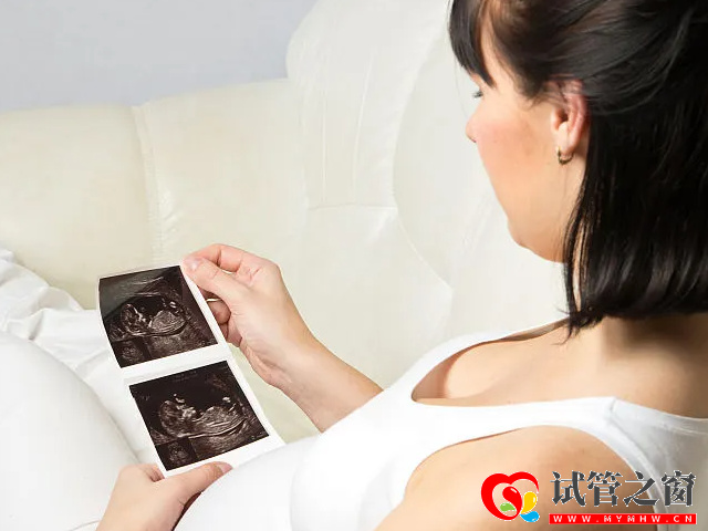 四维彩超男女参照图对比,一看有这个特征是男宝几率最大(图1) 四维彩超看男孩女孩诀窍