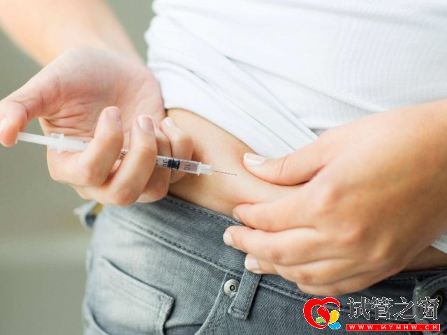 国内男性hiv携带者精子洗涤试管费用明细,让你宝宝更健康!(图2) 试管促排卵费用在一直两万元左右