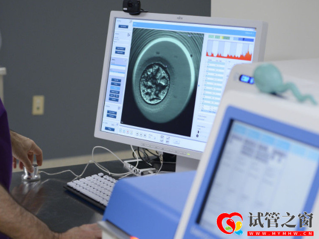 国内男性hiv携带者精子洗涤试管费用明细,让你宝宝更健康!(图3) 囊胚筛查费在40000元左右