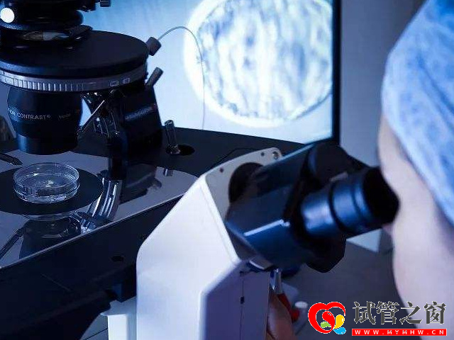 黄体期促排方案优缺点盘点,卵巢功能差提高获卵数就靠它(图2) 黄体期促排使用患者会经历两次取卵