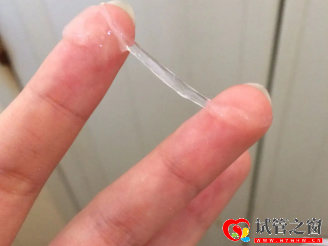 排卵期白带拉丝状图片分享,精准找排卵日还得要靠它(图2) 排卵期白带拉丝