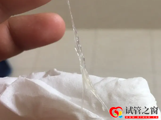 排卵期白带拉丝状图片分享,精准找排卵日还得要靠它(图3) 排卵期女性白带拉丝只有两到三天的时间